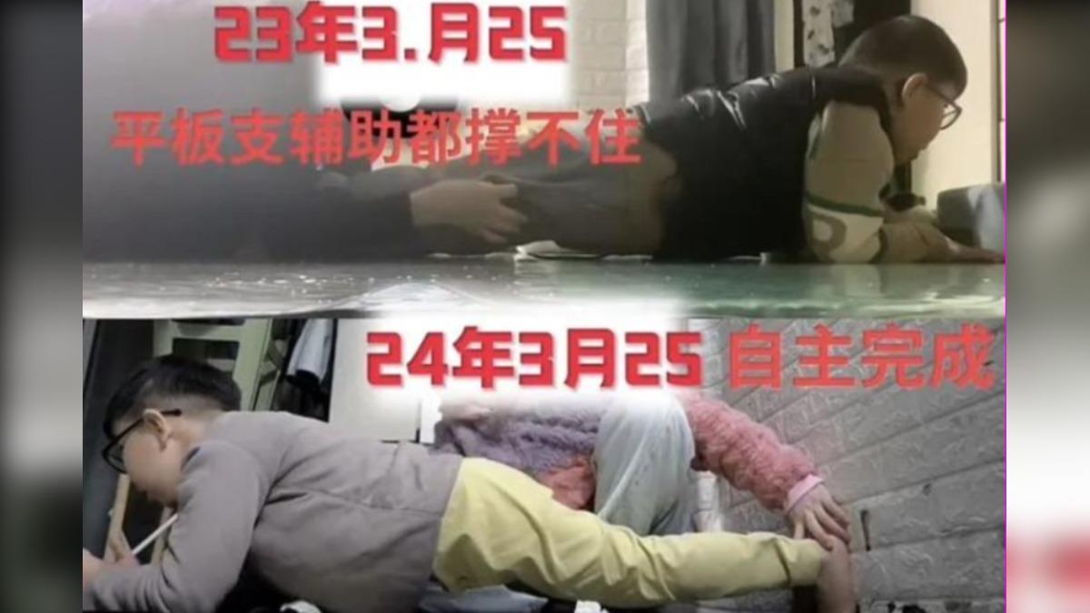 家人紀錄壯壯的復健過程。（圖／翻攝自澎湃新聞）