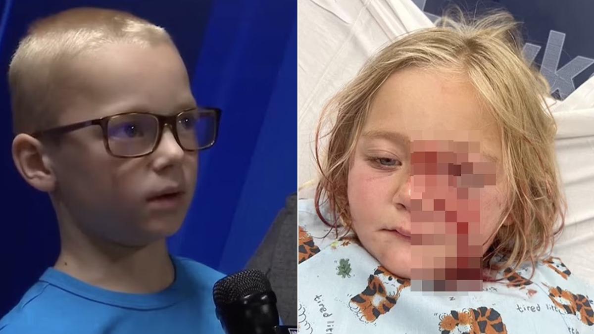 不想讓妹妹死掉!女童遭鬥牛犬瘋狂撕咬 8歲哥捨身阻止爆紅