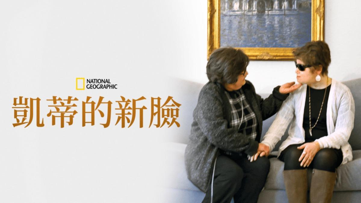 凱蒂18歲時試圖自殺導致面目全非,後來透過換臉手術,獲得重生機會。(圖/翻攝自Disney+)