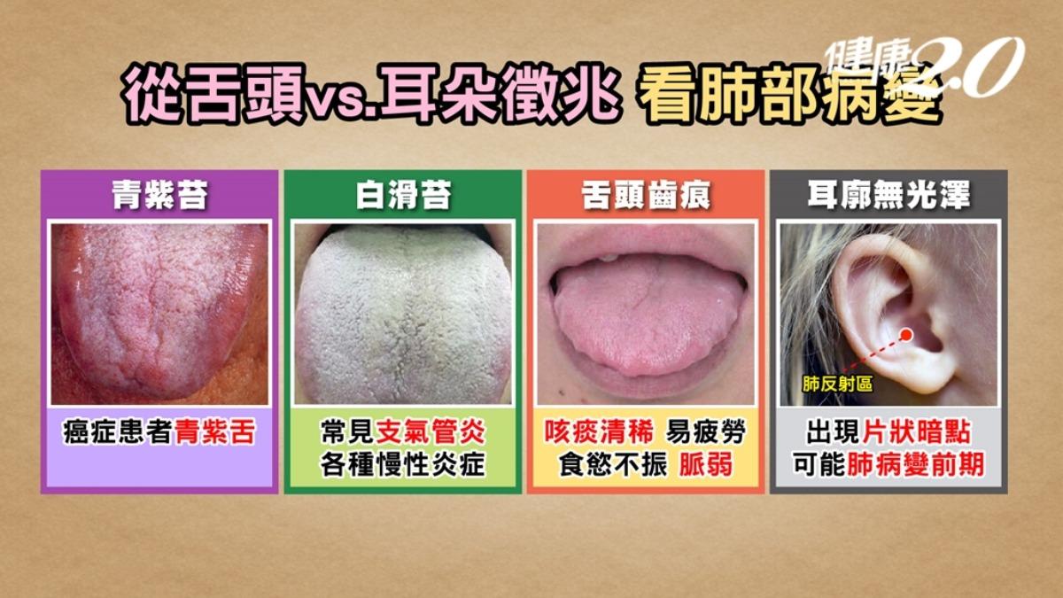肺部是否健康看舌頭、耳朵就知道。(圖/健康2.0)