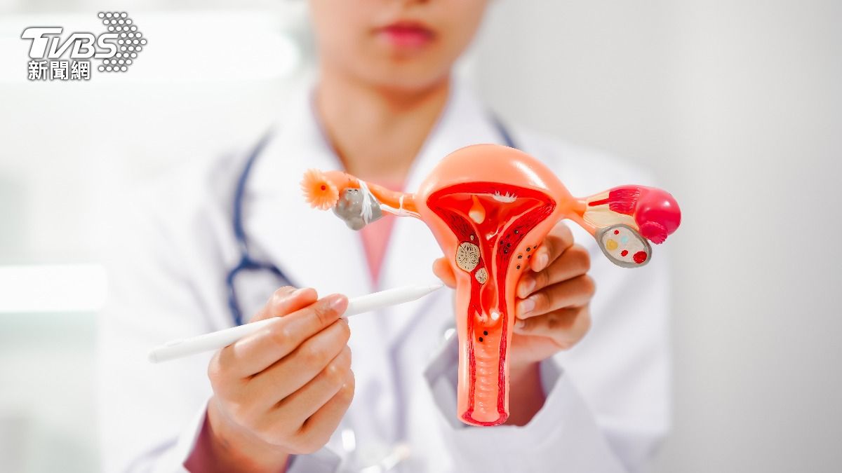 病患暴增15%!「5狀況」易罹子宮內膜癌 高血壓是高風險族群