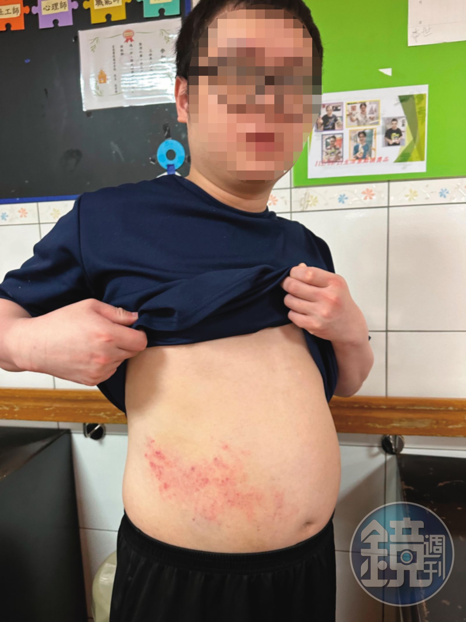 楊姓男子（圖）遭林智文拳打腳踢，腹部嚴重瘀傷。（圖／鏡週刊）