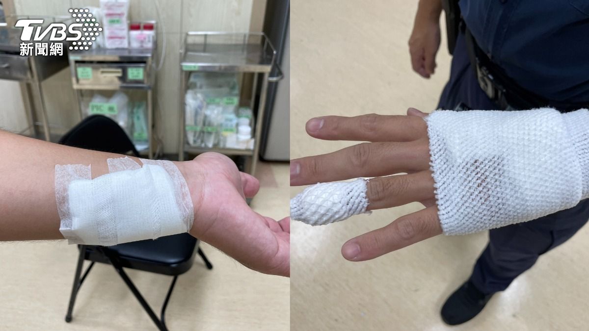4名員警手腳擦挫傷,其中一名腹部仍持續疼痛。(圖/TVBS)