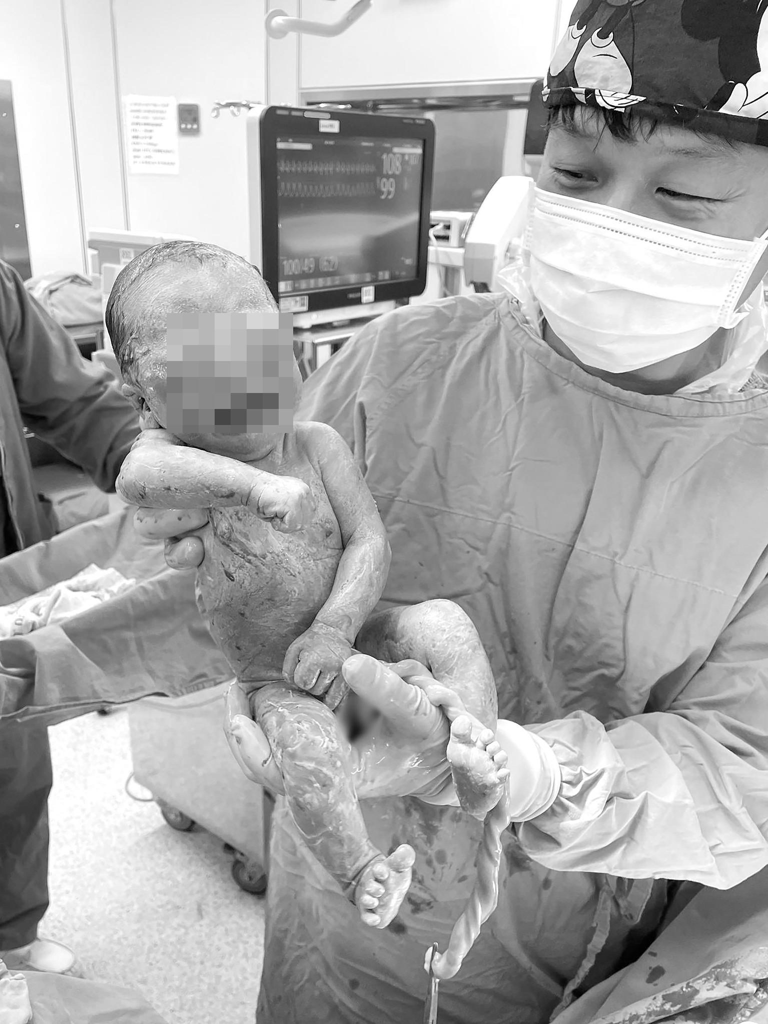 在過世兒子託夢後1週,就順利產下孩子,竟同天生日。(圖/翻攝施景中臉書)