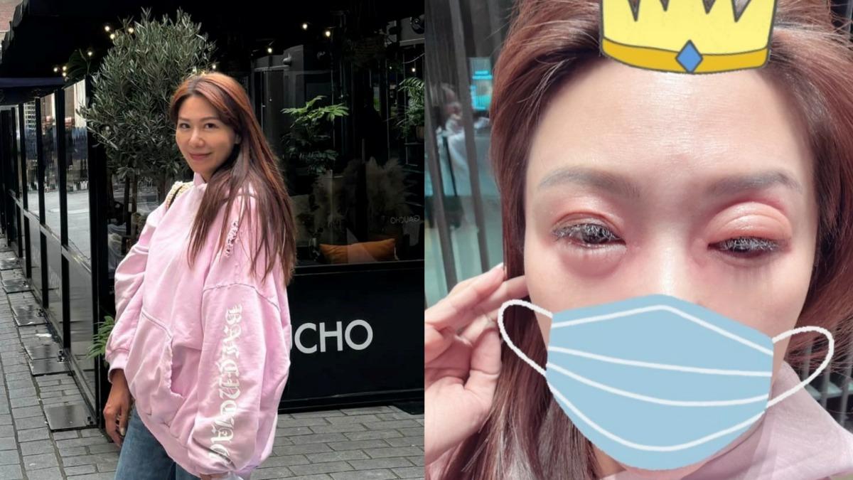 佩甄又出事了!「雙眼浮腫」慘變豬頭 名牌包被偷淚:對英國物價過敏