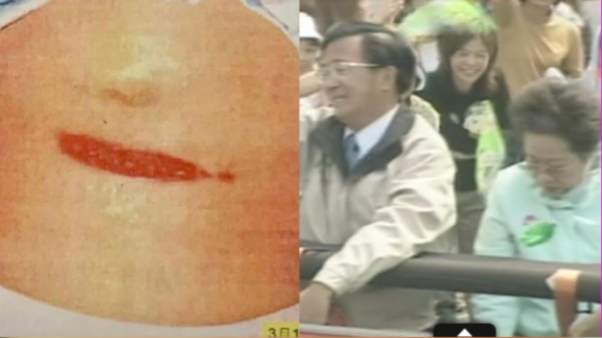 阿扁秀319中槍高清照!他「驚揭1細節」開轟:太尷尬了