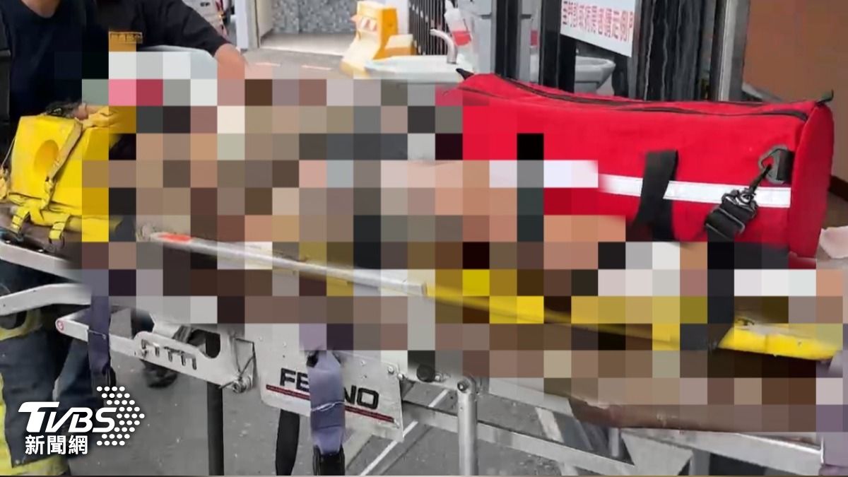 台東機車摔水溝竄火「燒到剩骨架」 女騎士25%二度灼傷