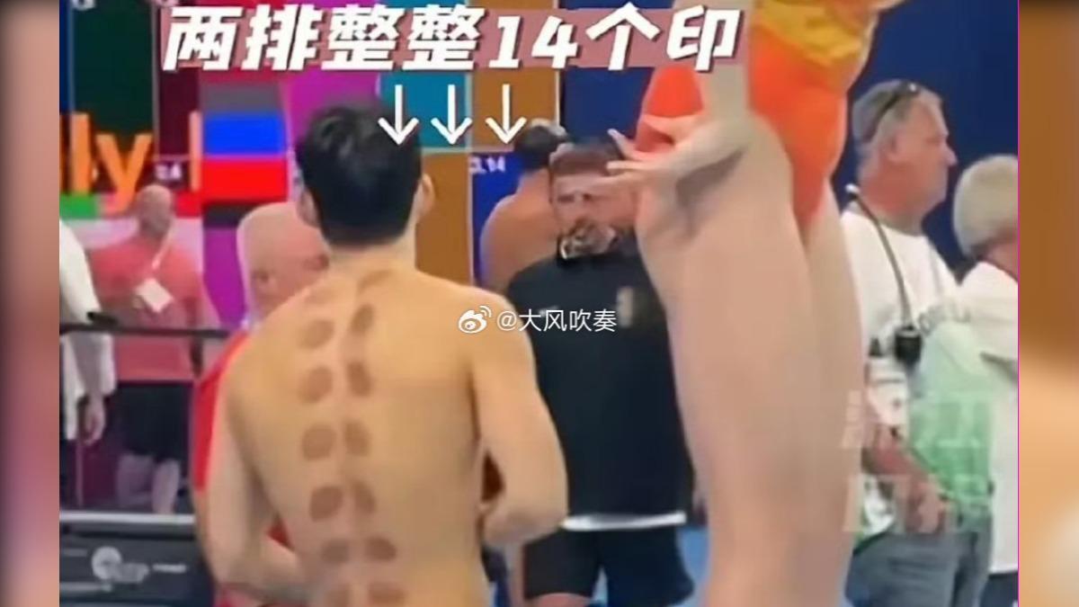 巴黎奧運/又見東方神秘力量!中國游泳選手背後滿滿「拔罐印」