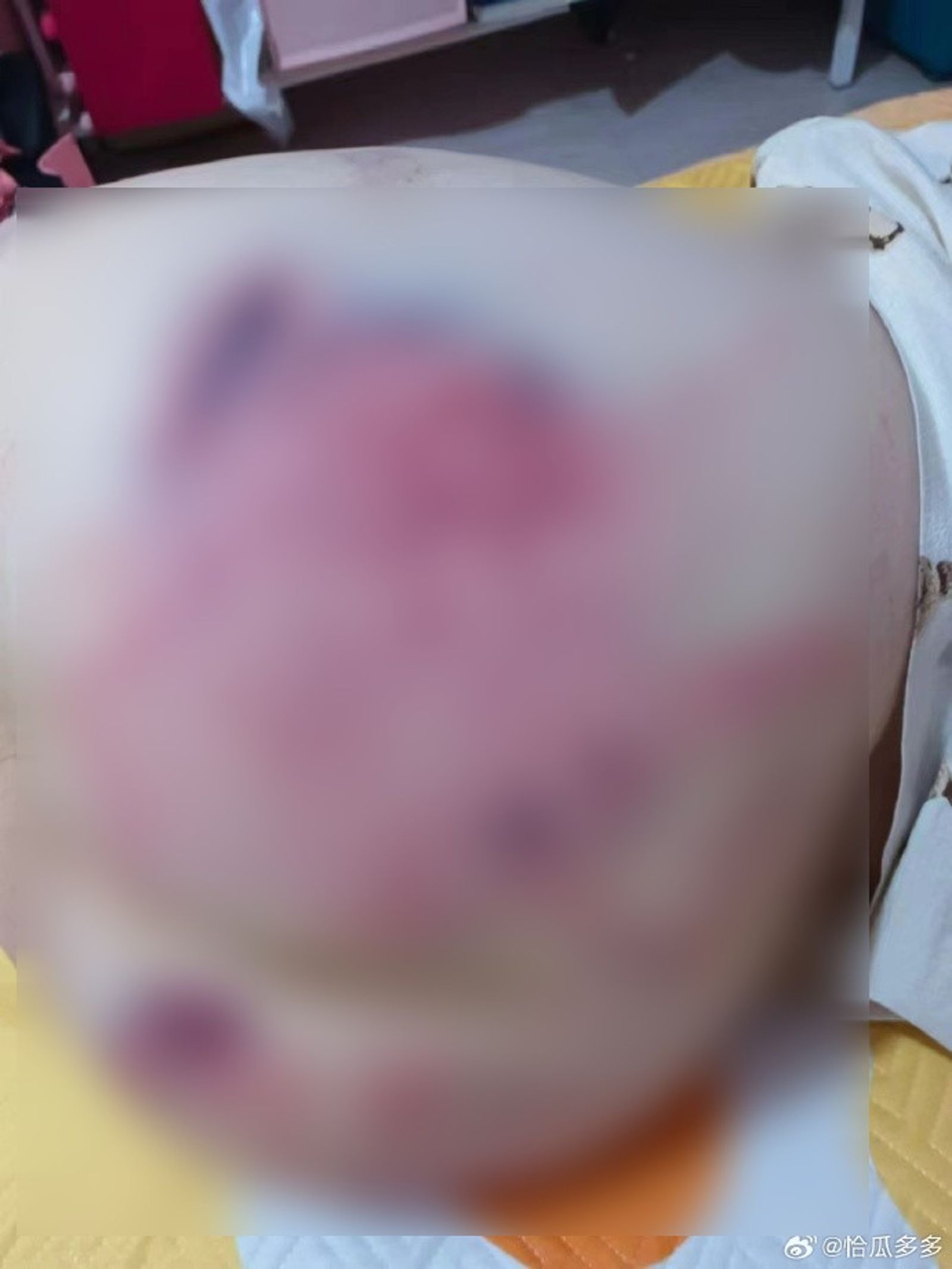 照片令人震驚。(圖/翻攝自微博)