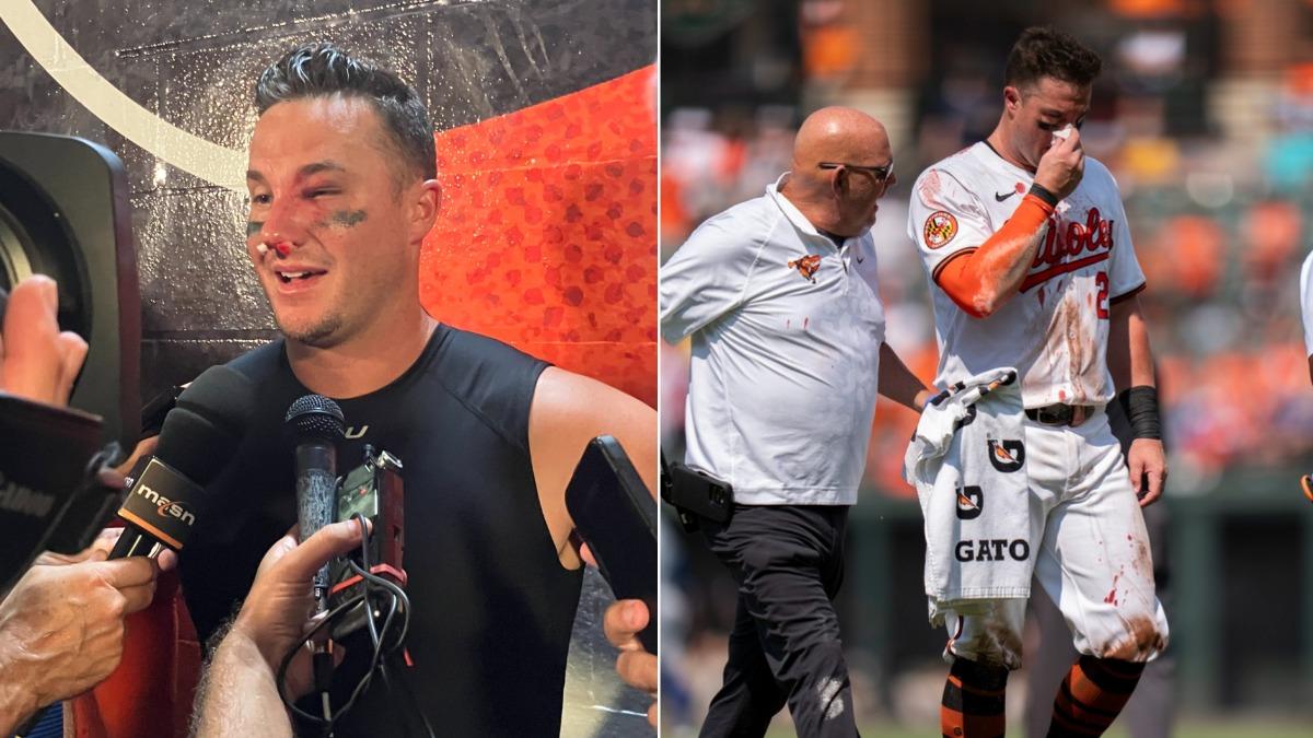 MLB/開賽就被砸中臉!金鶯鐵捕「鼻青臉腫」打完整場還受訪