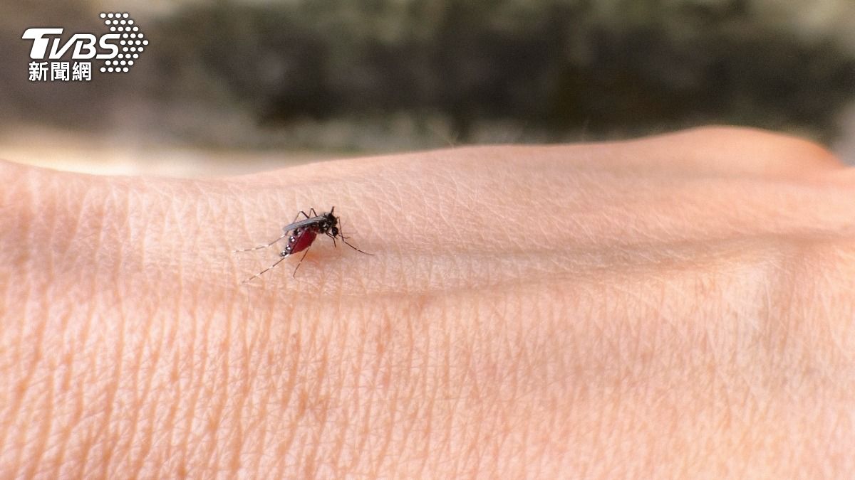 被蚊子咬「皮膚、指甲剝落」!英女水泡纏身 嚴重脫髮慘況曝
