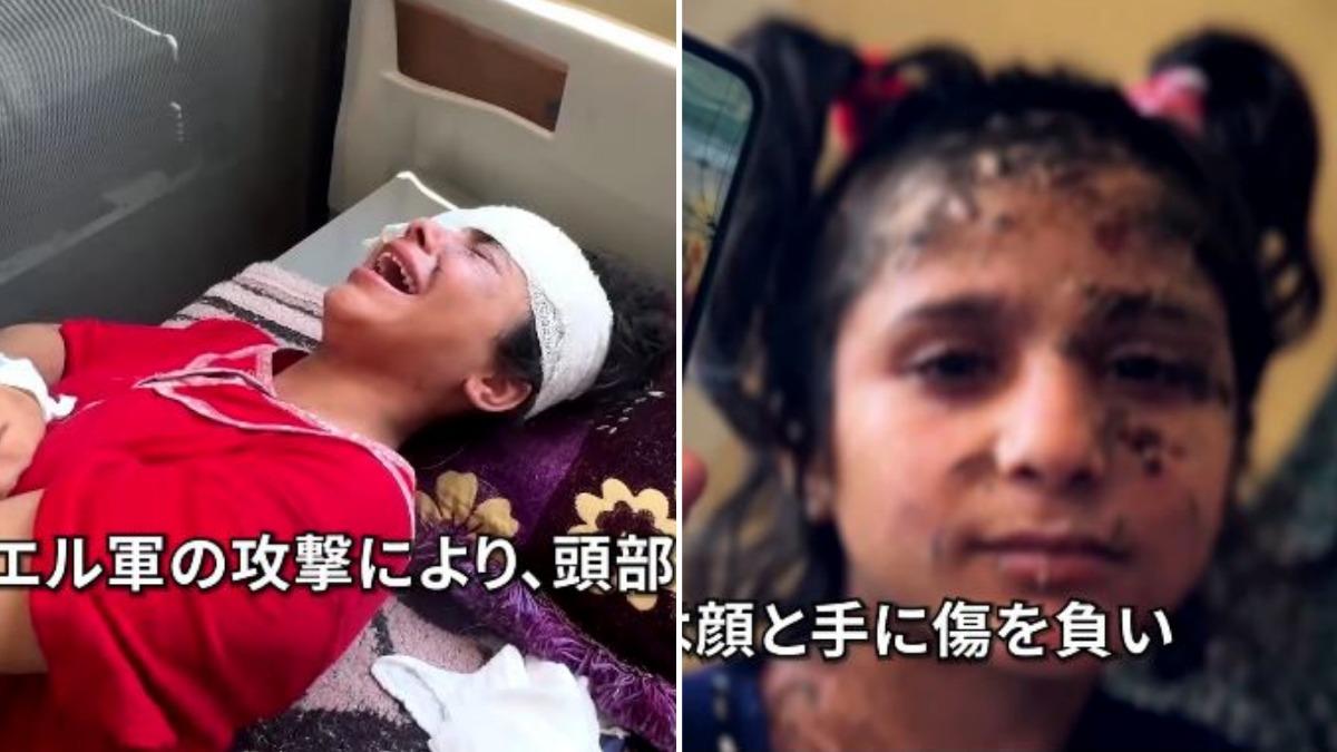 加薩姊妹遭以色列空襲失明 姊姊行醫夢碎痛哭:好想尋死