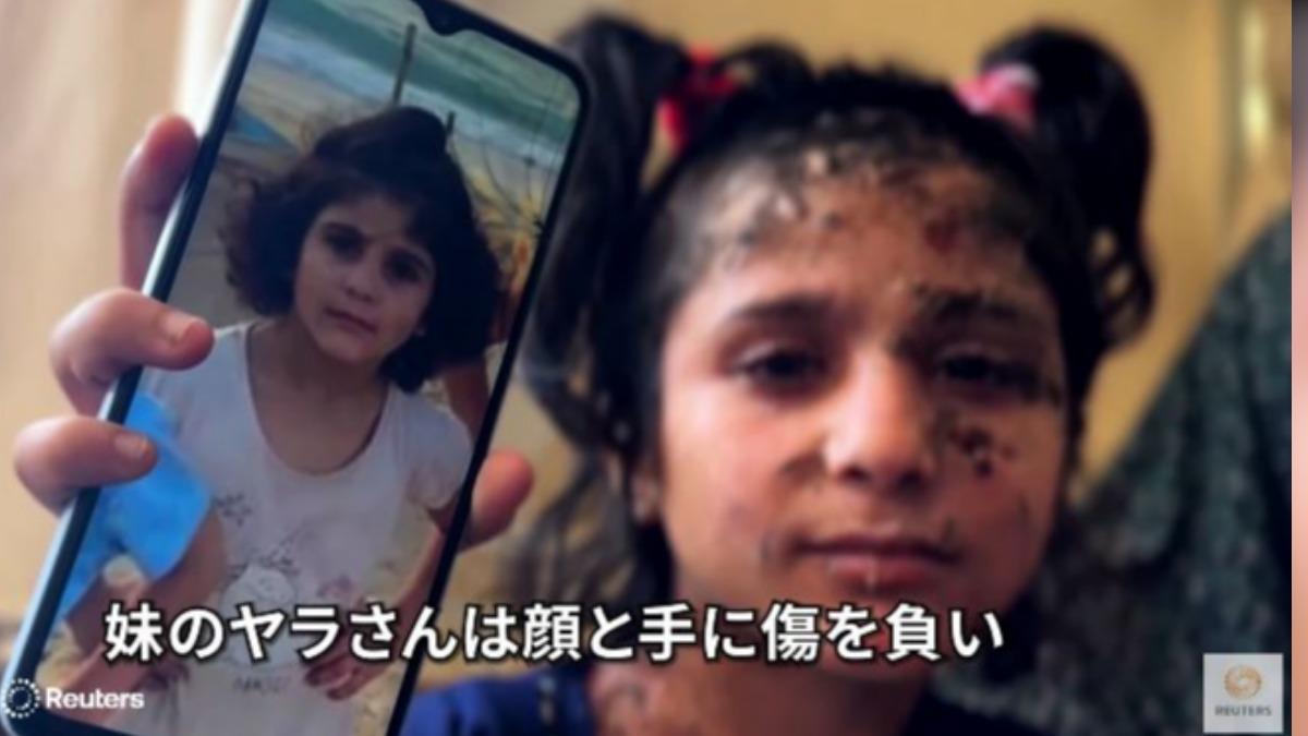 甘杜爾的妹妹雅拉也在這一場空襲中受傷。 （圖／擷取自Reuters Japan）