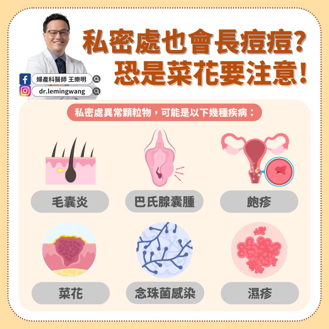 私密處長痘痘「恐是菜花」要注意。（圖／翻攝自婦產科醫師王樂明臉書）