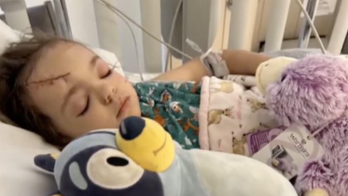 奧莉維亞的頭骨被野馬踢到裂開，所幸經過3個小時的手術順利撿回性命。（圖／翻攝自YouTube@Fox5 Las Vegas）