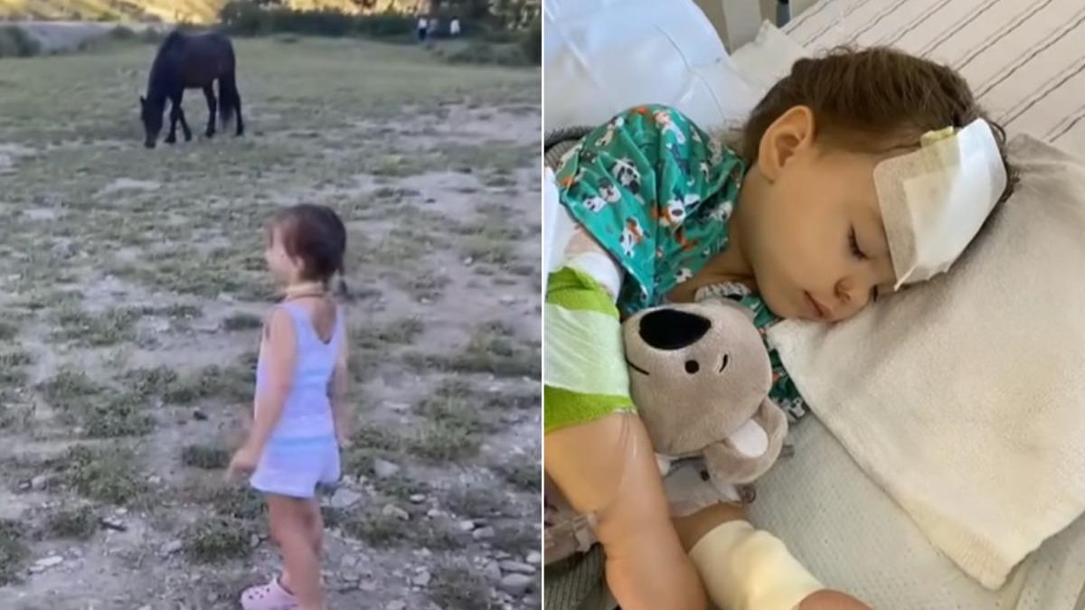 美3歲女童踏青被野馬狠踹!母目睹「頭骨裂開」驚呼:以為死了