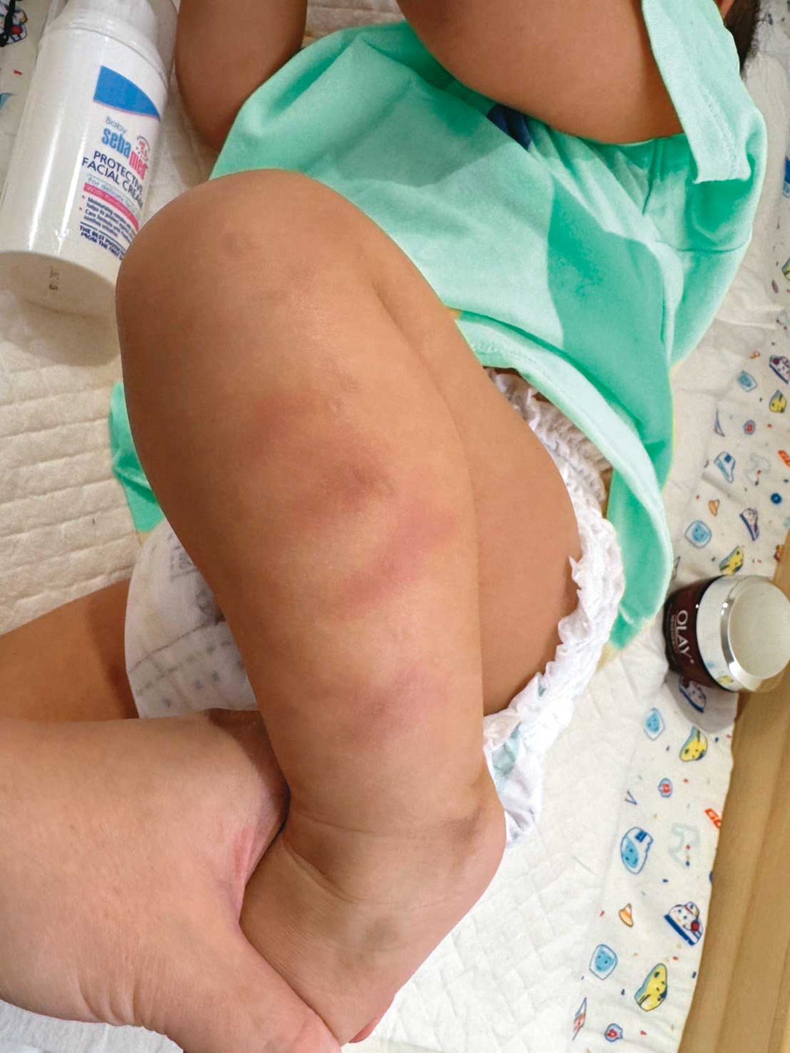 A妻上月發現小孩腿上有手指狀瘀青,驗傷報案並調閱監視器後才知兒子遭虐。(圖/鏡週刊)