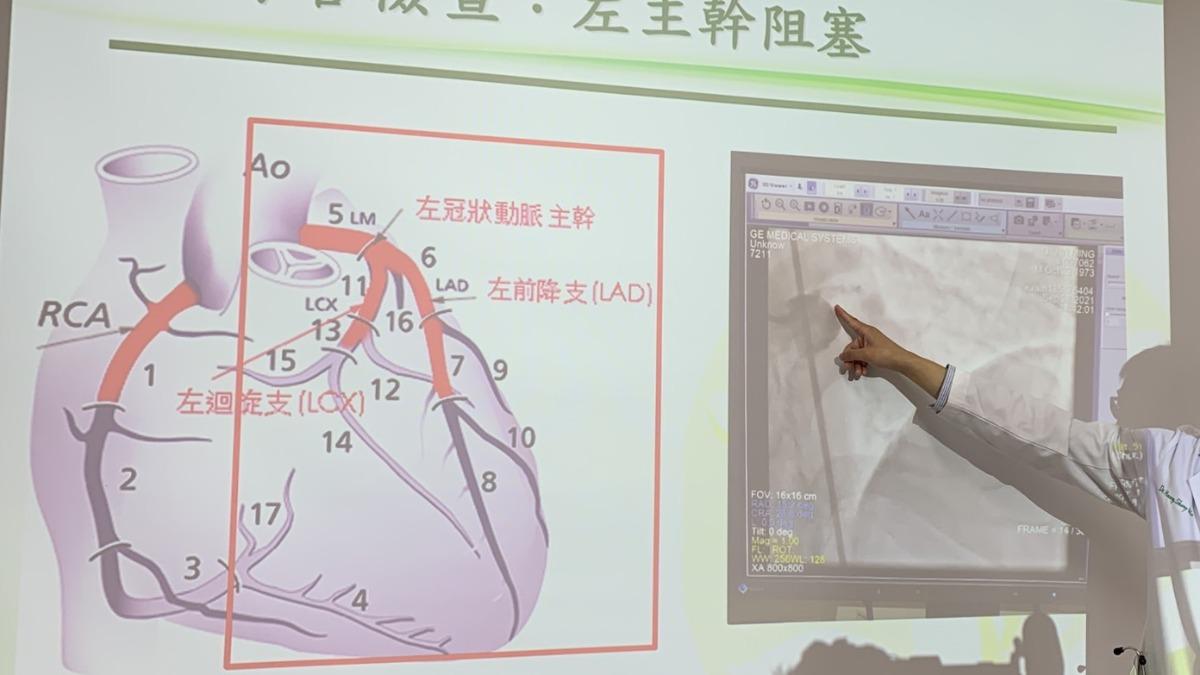 台中老菸槍開車上班!突離奇昏迷自撞 頭部重創「動脈全塞住」