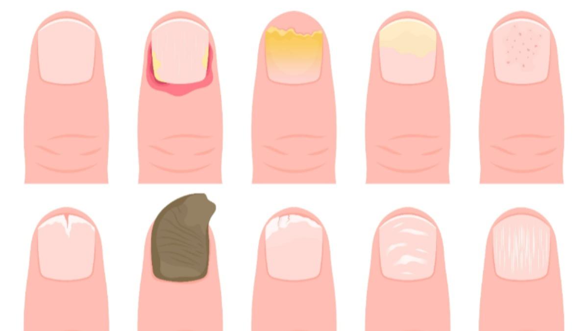 10種指甲狀況看健康。(圖/女人我最大)