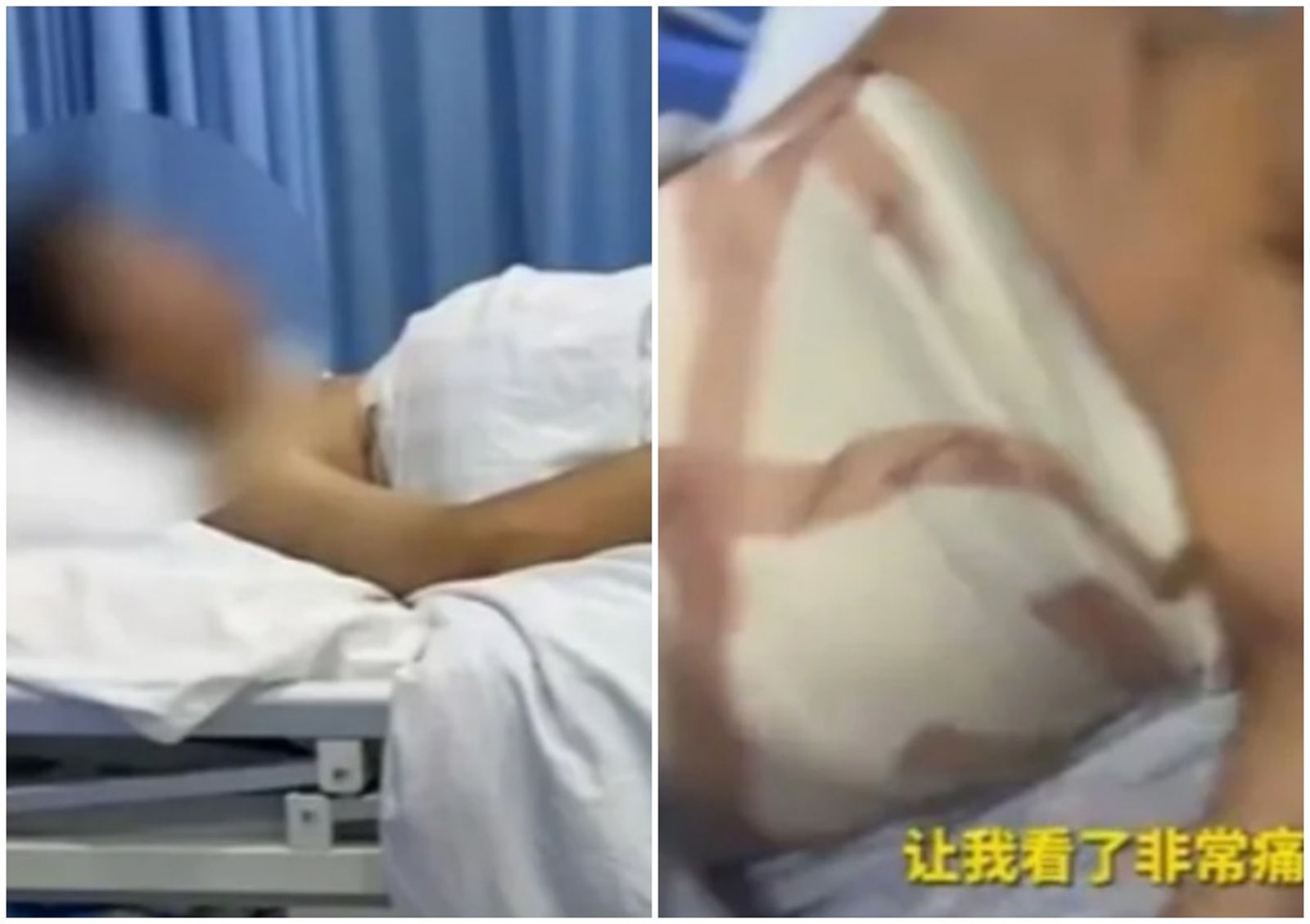 陸男醫美診所找工作遭騙貸款「隆乳」變B罩杯! 母怒:他智力僅5歲