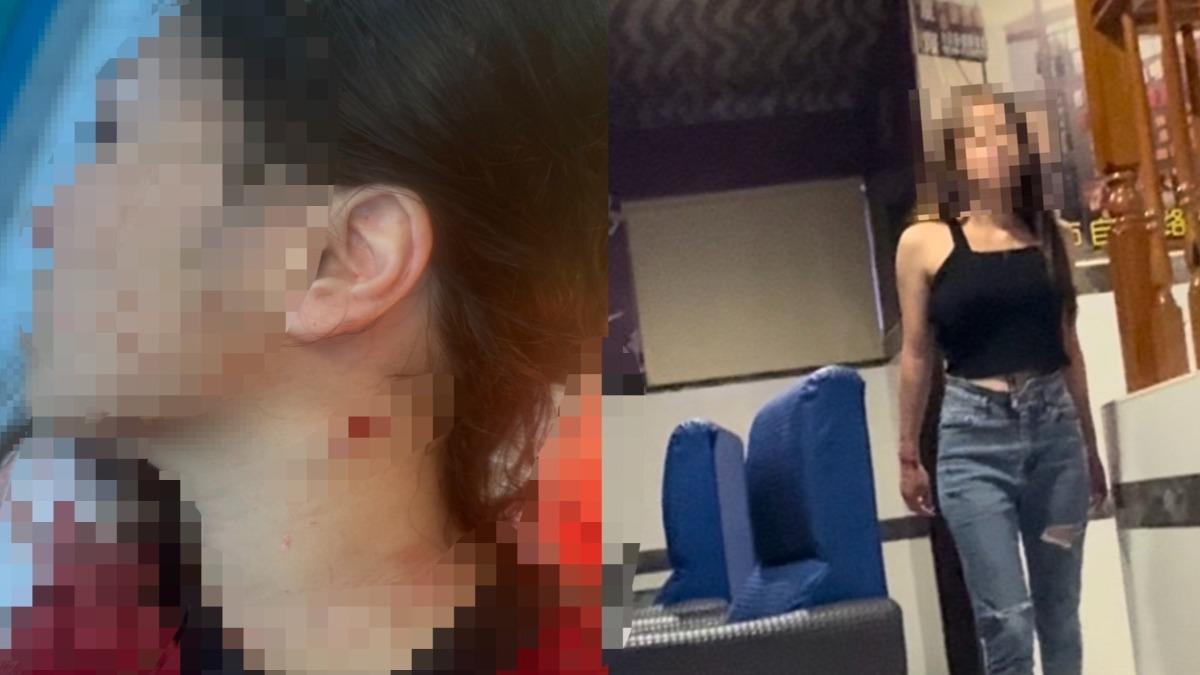 痛毆前任反遭設局凌虐！她逃劫控警「大案小報」　警方回應