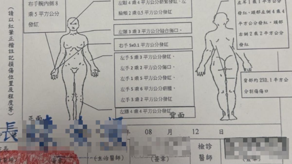 吳女秀出驗傷單。(圖/當事者提供)