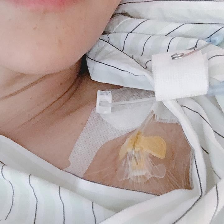 唐玲今年裝置人工血管。(圖/翻攝自唐玲臉書)