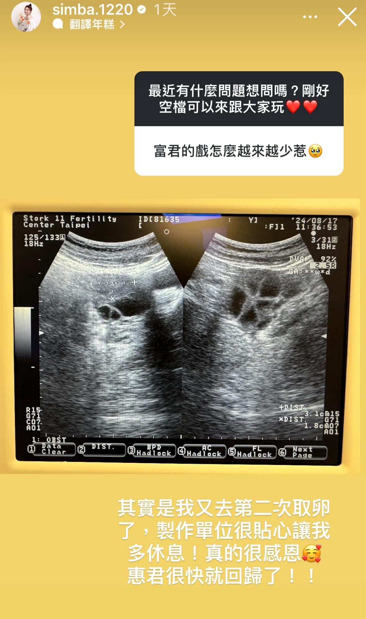 曾智希再度取卵。（圖／翻攝自曾智希IG）