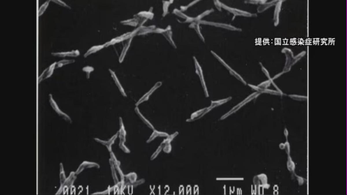 黴漿菌肺炎的主要症狀包括發燒、疲倦和長時間咳嗽。(圖/翻攝自東海テレビ)