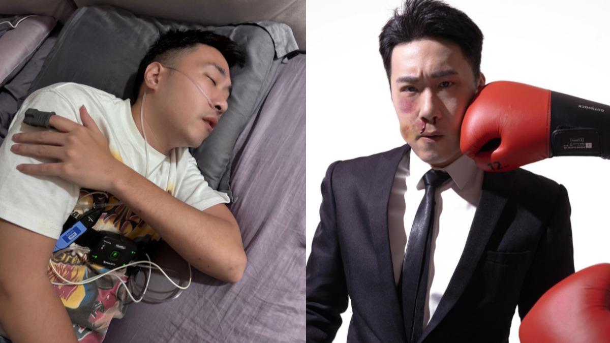 余祥銓驚爆被揍!大片瘀青「臉腫狂流鼻血」苦認:霸凌始祖是我