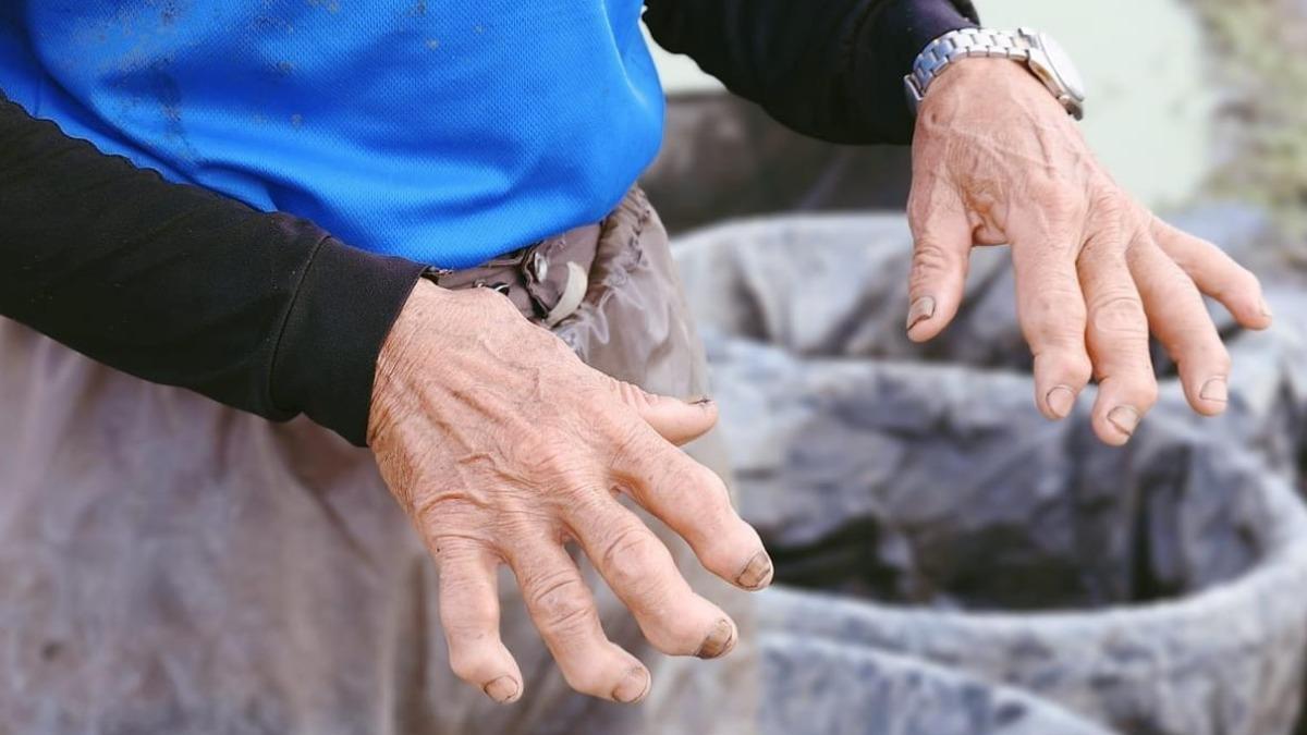 蓮藕怎麼來?農民挖到「老鷹之手」常半夜痛醒 震撼畫面曝