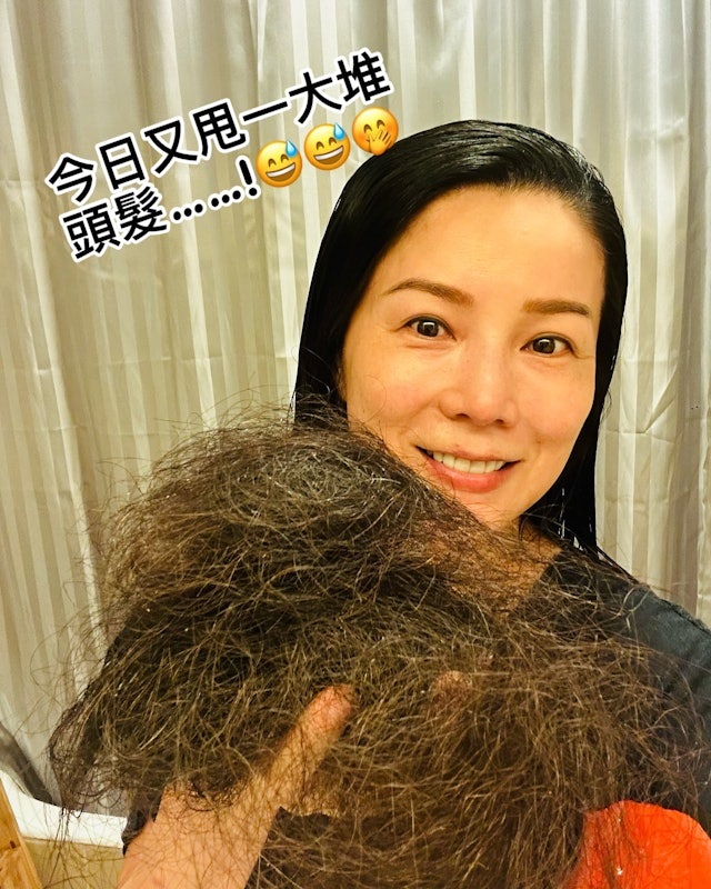 女星吳文忻樂觀PO掉髮照惹心疼。（圖／翻攝自＠nat_ng_nat IG）