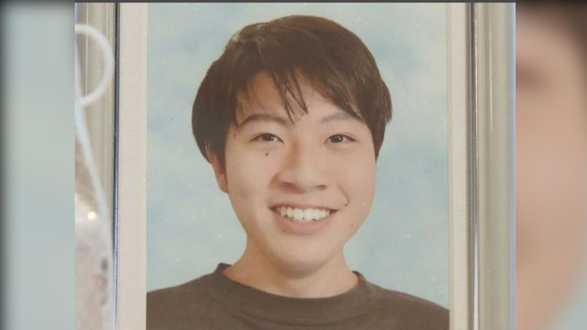 17歲男拔牙拔到死!日牙醫「氣管錯插食道」 業務過失致死遭偵辦