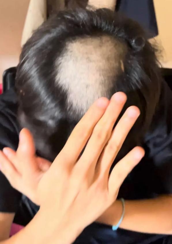 泰國學生頂著地中海禿頭感到備受屈辱。(圖/翻攝自Thairath)