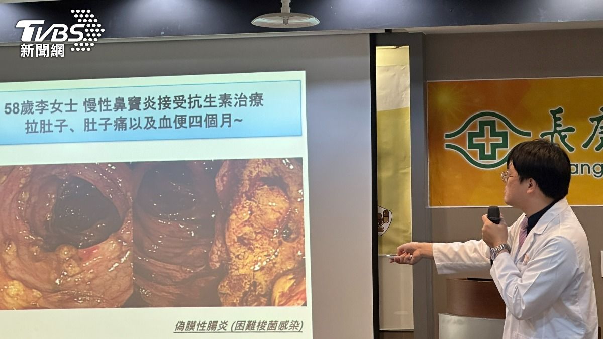 林口長庚紀念醫院微菌治療中心及發炎性腸道疾病中心主任李柏賢。(圖／許稚佳攝)