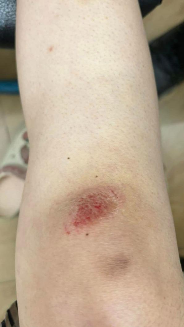 駕駛受傷從門縫裡面爬出來。（圖／翻攝自爆料公社）
