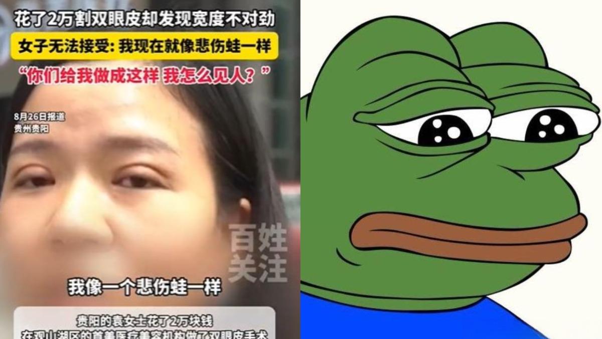 陸女花9萬割雙眼皮!術後一看崩潰 淚認整殘「撞臉悲傷蛙」
