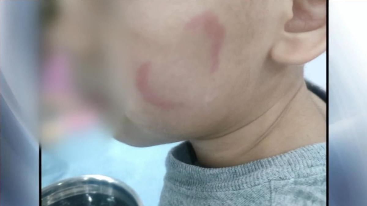 圖/照片家長提供