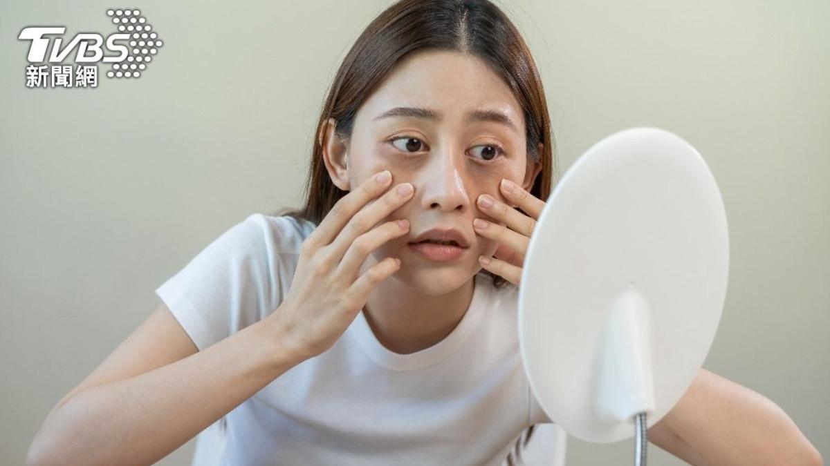 貓熊眼OUT！專家揭黑眼圈「3大類型」　搭配飲食療法輕鬆改善