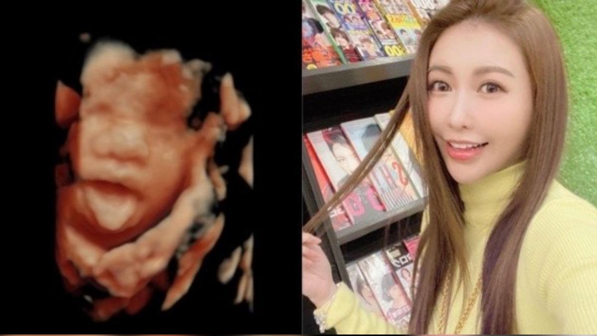 突曬超音波照!愷樂「孩子生父」身分曝光 友親證實揭復出可能