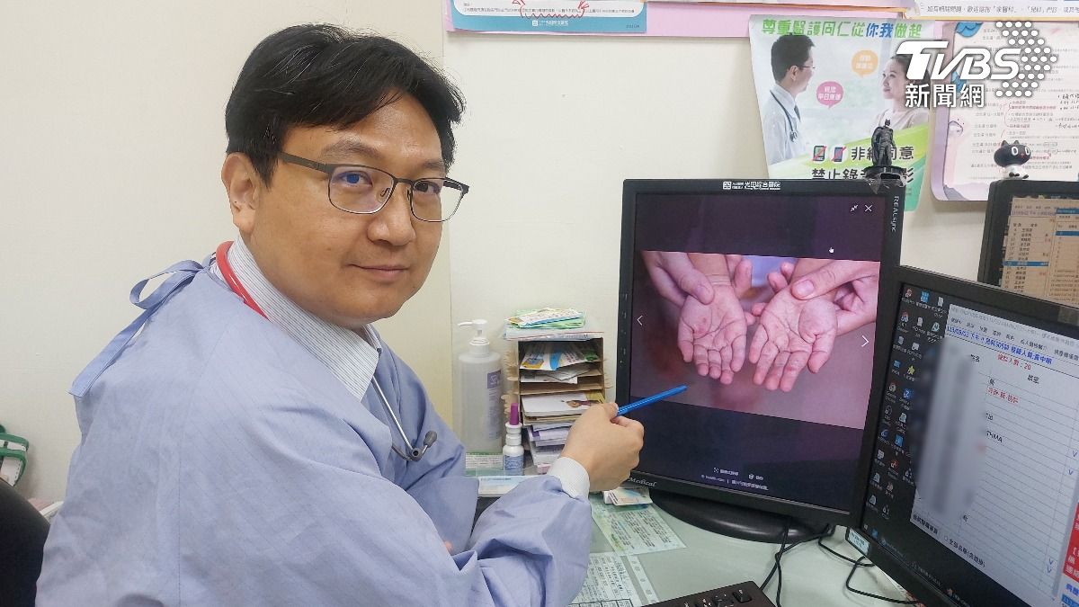 光田綜合醫院大甲院區兒科副主任黃中明醫師。(圖/TVBS)