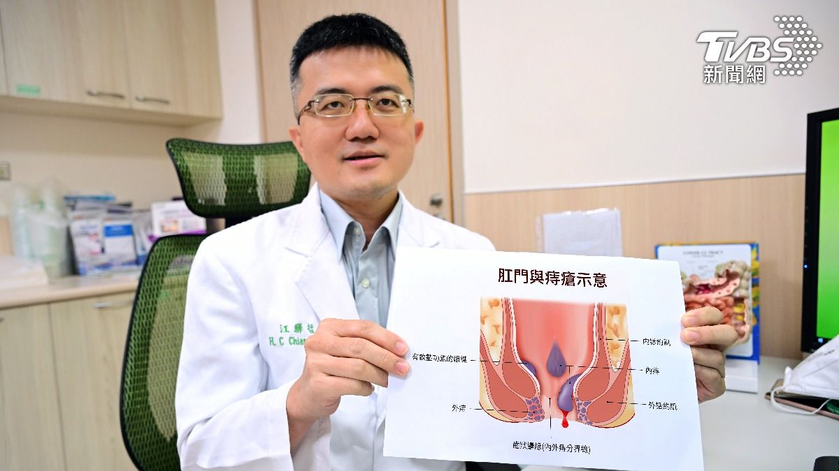 女子自費雷射消融手術康復。(示意圖,非當事人/亞大醫院提供)