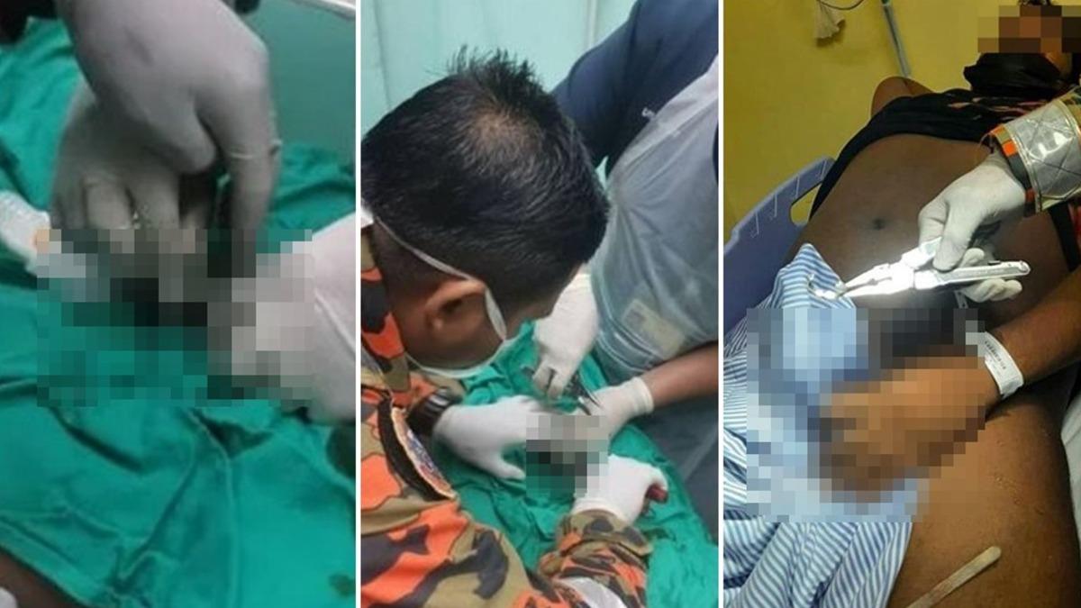 GG戴戒出事了！他卡住崩潰急就醫　4消防出動「解開束縛」