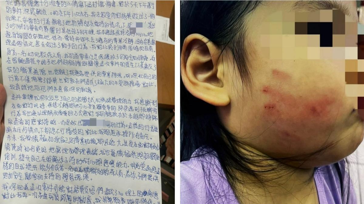 桃園女童遭「甩巴掌」濺血!教保員僅寫悔過書 教育局回應了
