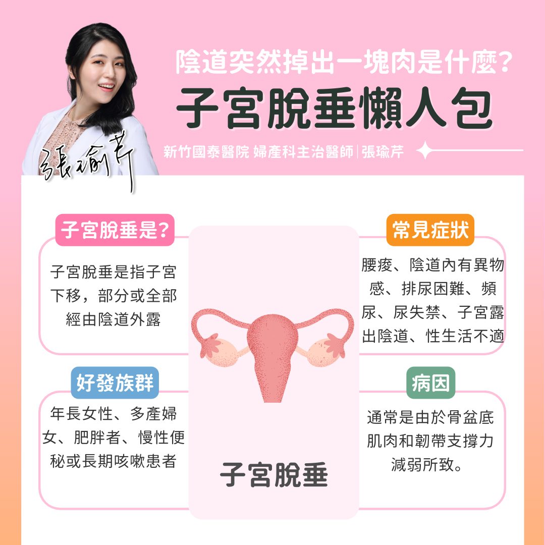子宮脫垂懶人包一次看。(圖/張瑜芹醫師授權提供)