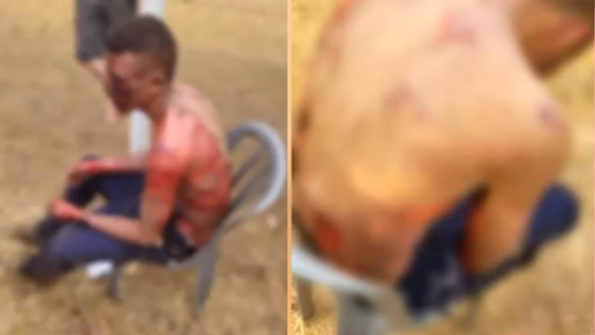 超市偷涼鞋被動私刑 巴西男遭老闆「潑酒精縱火」80%灼傷亡