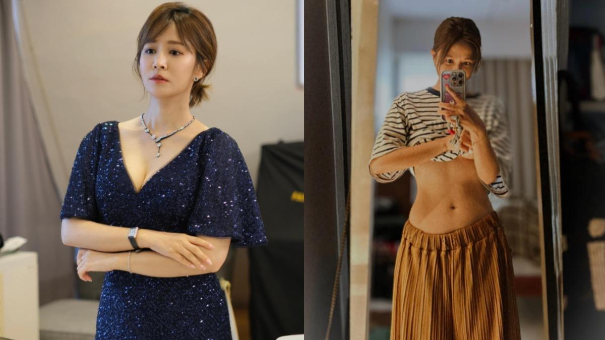 44歲女主持驚爆「大量失血」!罹惡疾瀕暈倒邊緣 開刀保子宮