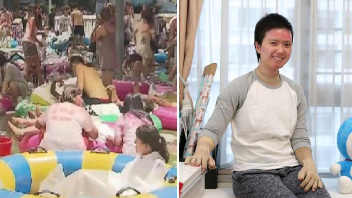 星國女來台遇八仙塵爆全身80%灼傷險死　9年後從醫攻燒燙傷