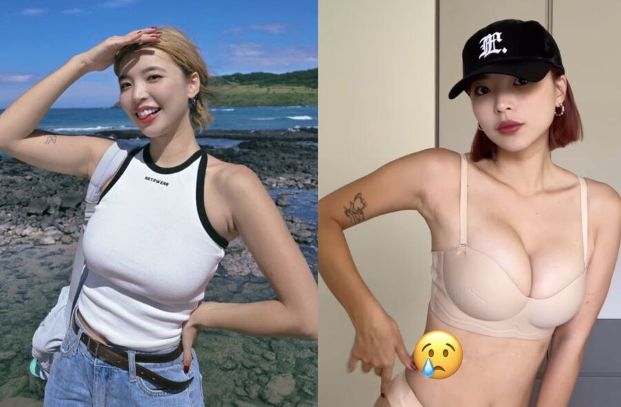 擁有高人氣的百萬YTR「一隻阿圓」,坦言其實自己剩只1顆腎臟。(圖/翻攝自一隻阿圓IG)