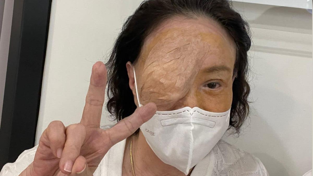 集氣!資深女星突「入院開刀」 認了:需要大家祝福